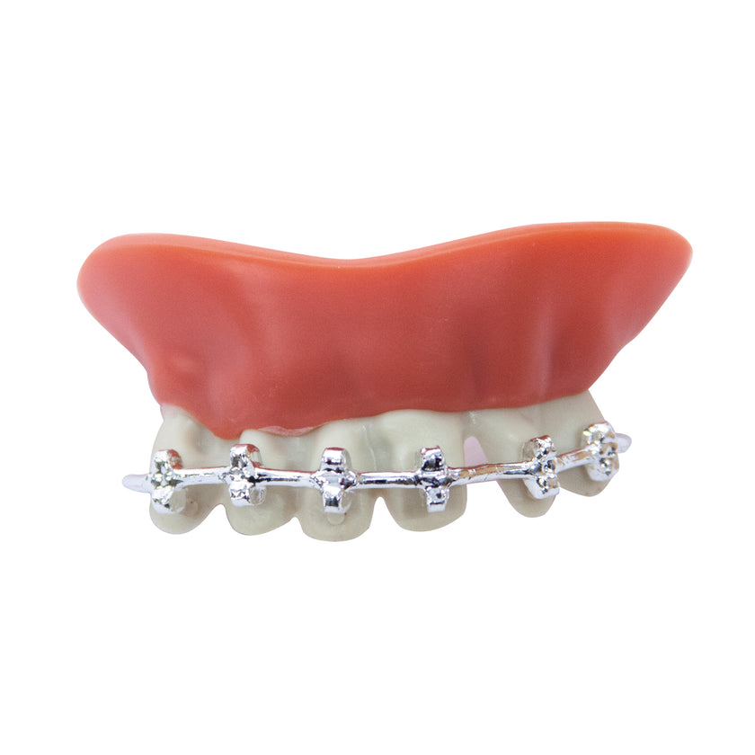 DENTIER AVEC APPAREIL DENTAIRE (nécessaire de fixation inclus)